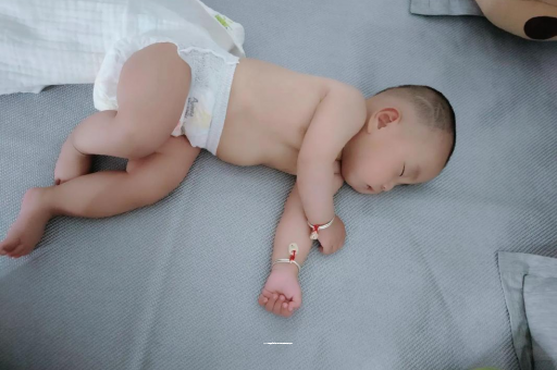 睢县六个月宝宝眼睛散光